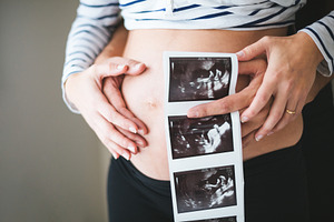 Couple hands holding ultrasound imag