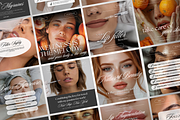 Med Spa Instagram Templates Bundle, a Social Media Template by DesignsbyMariaStudio (Thumbnail 3 of 10)
