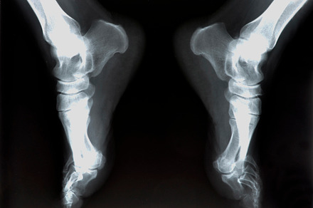 Xray of foot stock photo containing test and medical, a Health & Medical Photo by neftali77