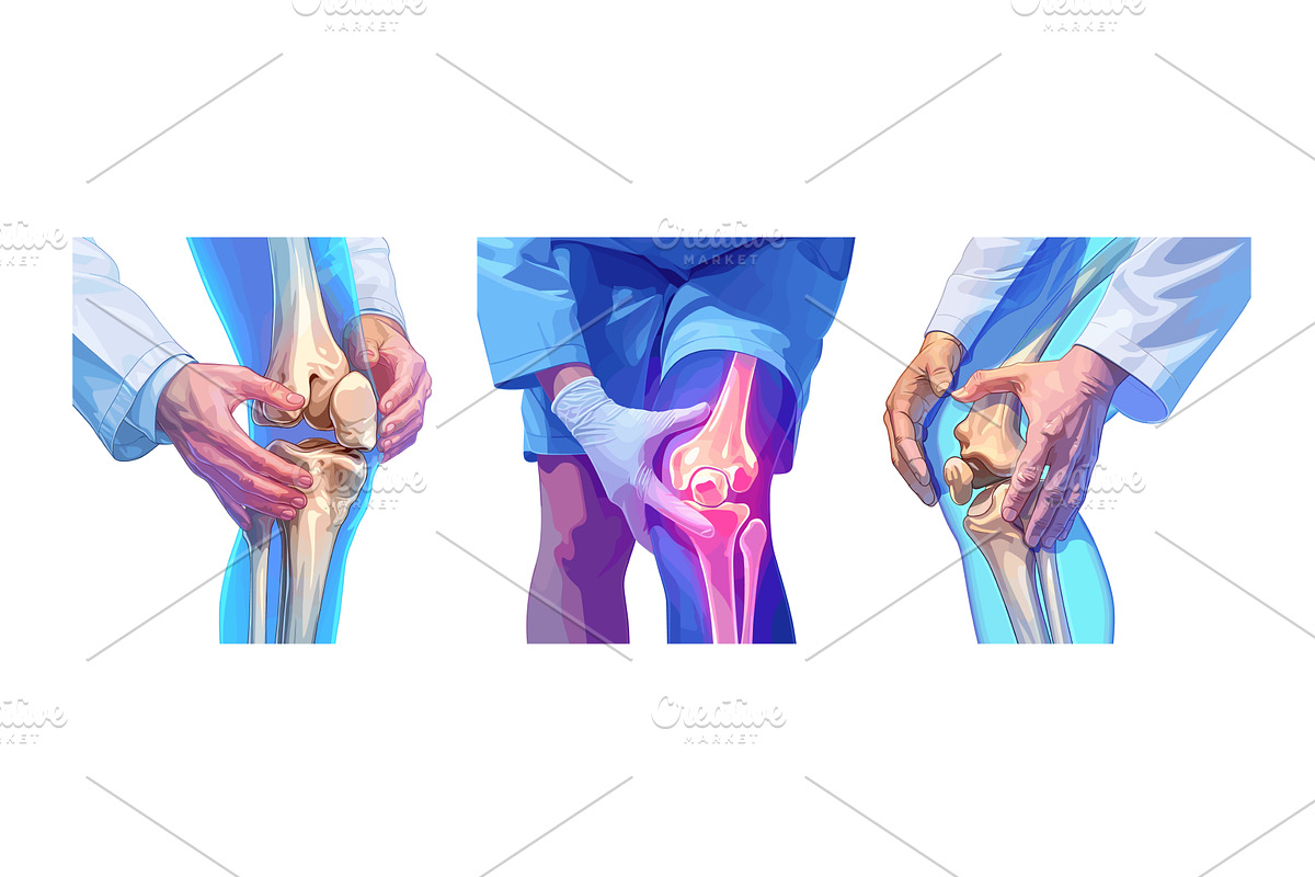 Knee joint. Leg bone arthritis pain, an Object Illustration by Stock-Smart-Start