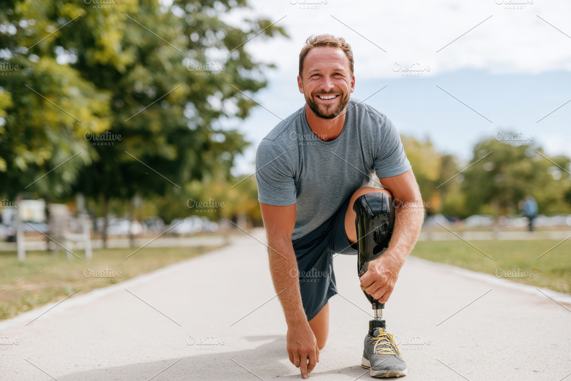 Smiling man with prosthetic leg in park, a Sports & Recreation Photo by AlyaAnd