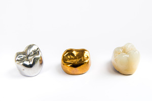 Dental ceramic gold and metal tooth crowns on white background isolated