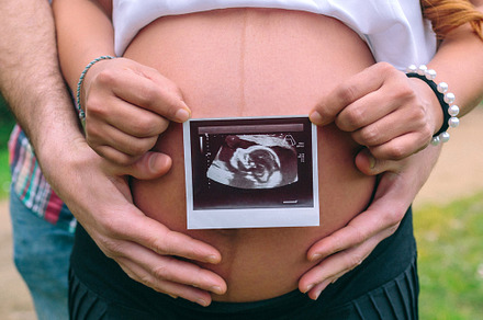 Female pregnant showing ultrasound scan of baby while her partner holding her b, a Person Photo by davidpereiras