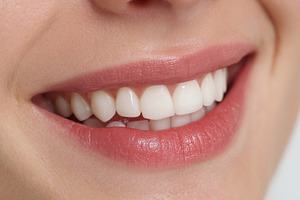 Close up of a woman's mouth smiling, a Person Photo by MistyDay