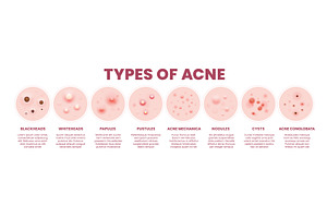 Body skin acne type pore, a Healthcare Illustration by Vector Tradition