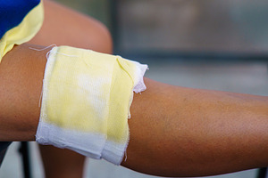 Knee pain in an elderly person use thai herbal compress ball or, a Health & Medical Photo by Casanowe-studio