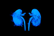 Smoky shapes of human organs, a Healthcare Illustration by Julvil (Thumbnail 5 of 7)