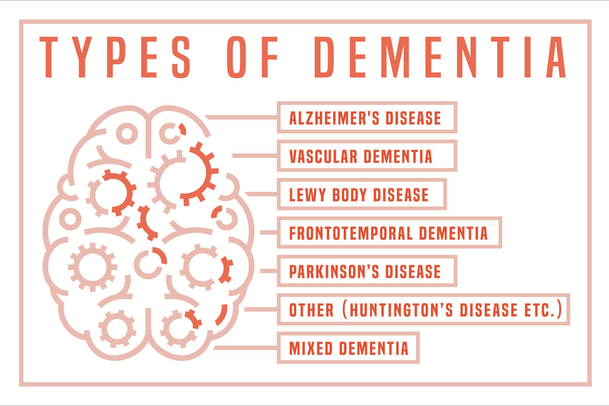 Vector dementia infographic, a Healthcare Illustration by Anna's Shop