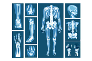 Xray films. X-ray radiology film, a Healthcare Illustration by Stock-Smart-Start