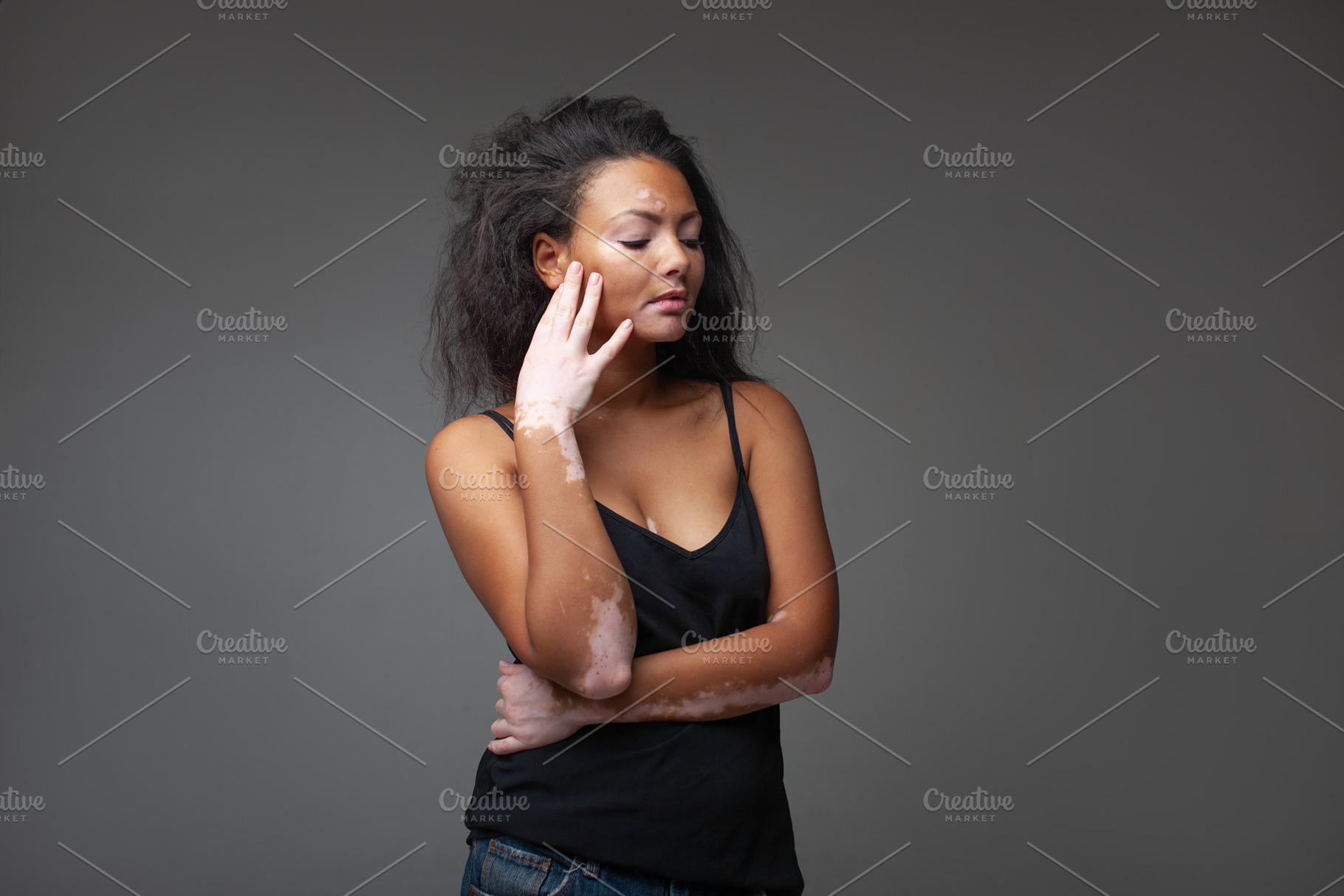 Sensuous fashion model with vitiligo posing against gray background, a Photo by andreonegin market