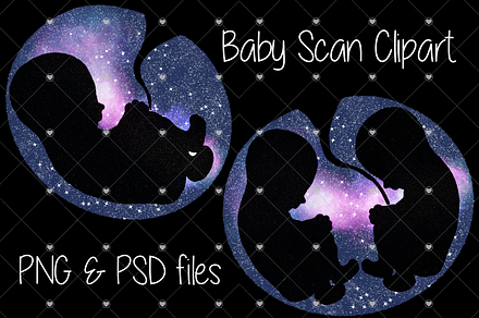 Baby, Scan, Rainbow baby, Pregnancy,