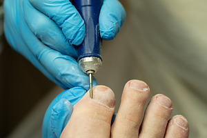 Technician performs dry pedicure, a Health & Medical Photo by Elena Vagengeim