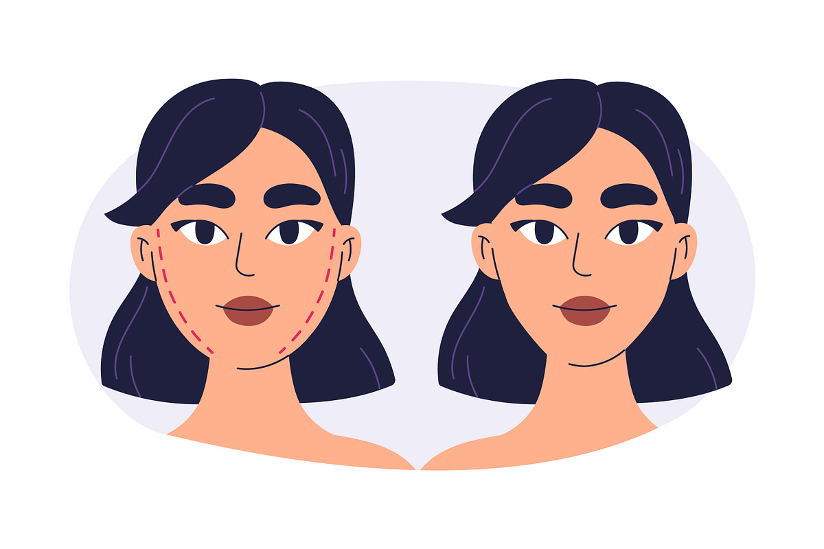 Plastic surgery in beauty clinic set, a Healthcare Illustration by Good Studio (Photo 2 of 12)
