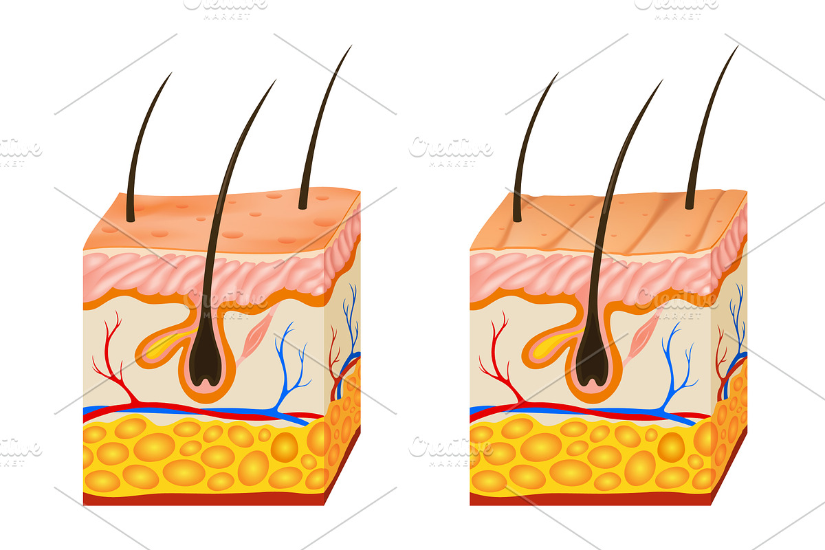Oily and dry skin anatomy, an Object Illustration by Things for designers