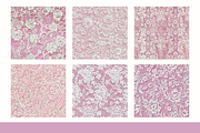 Pink Lace Pattern Digital Paper, a Pattern Graphic by Paper Artsthetics (Thumbnail 2 of 4)