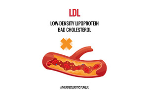Type of cholesterol in human, an Object Illustration by Things for designers